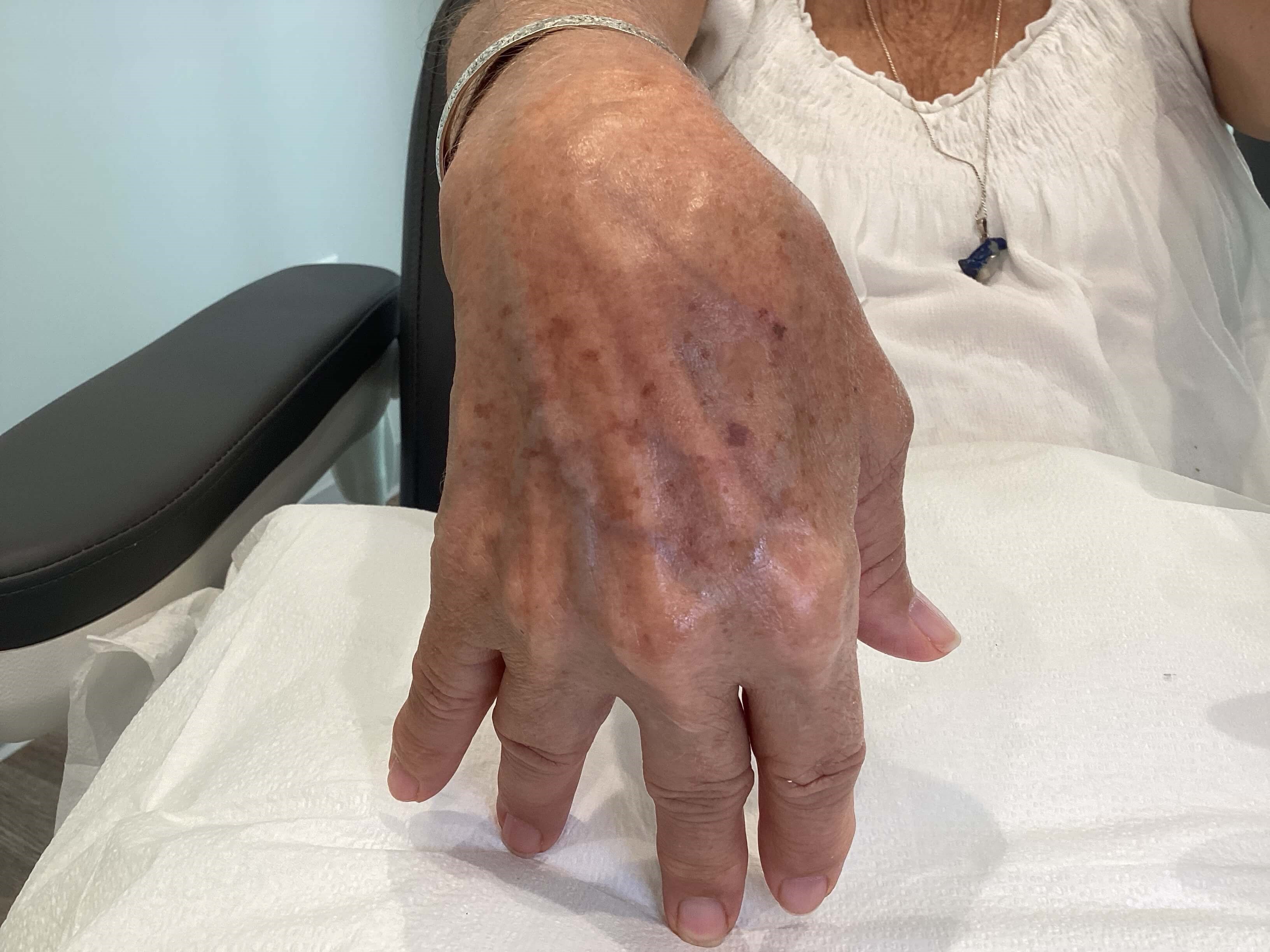 Right Hand Before