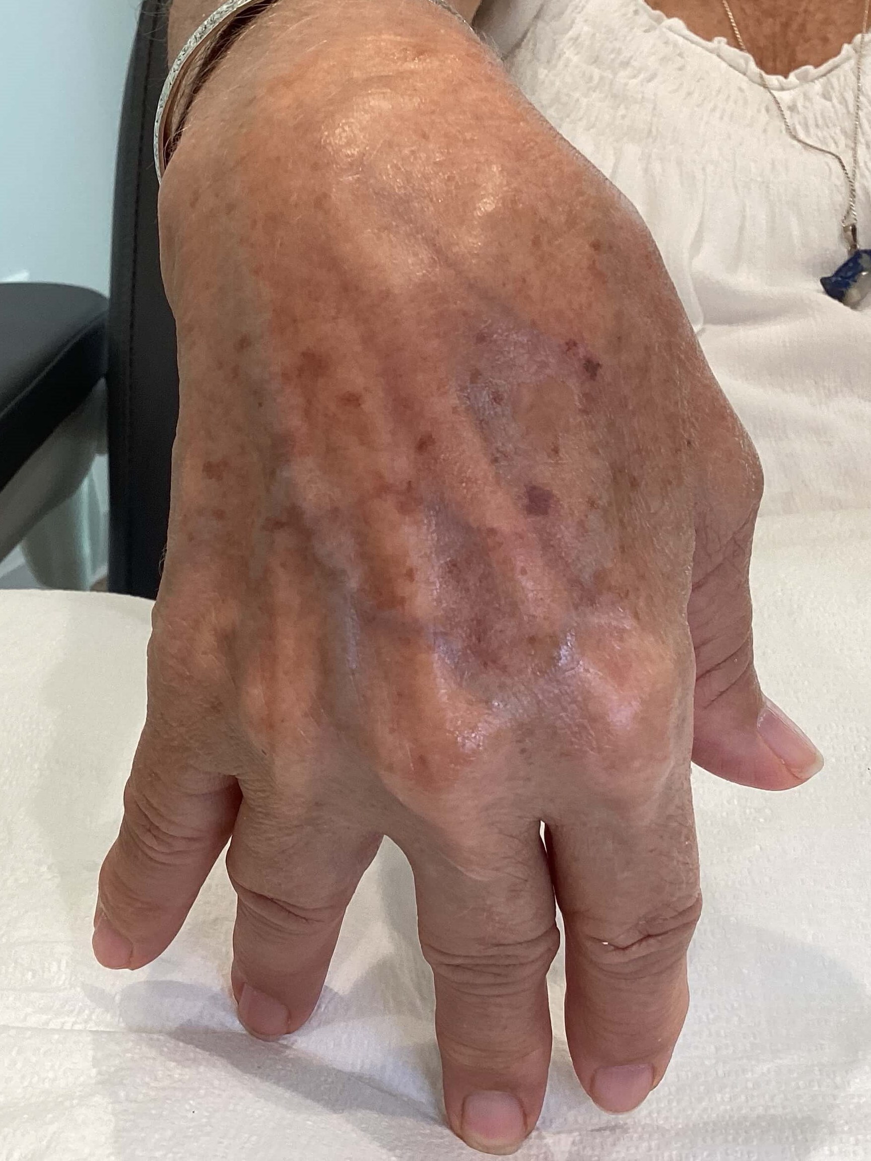 Right Hand Before