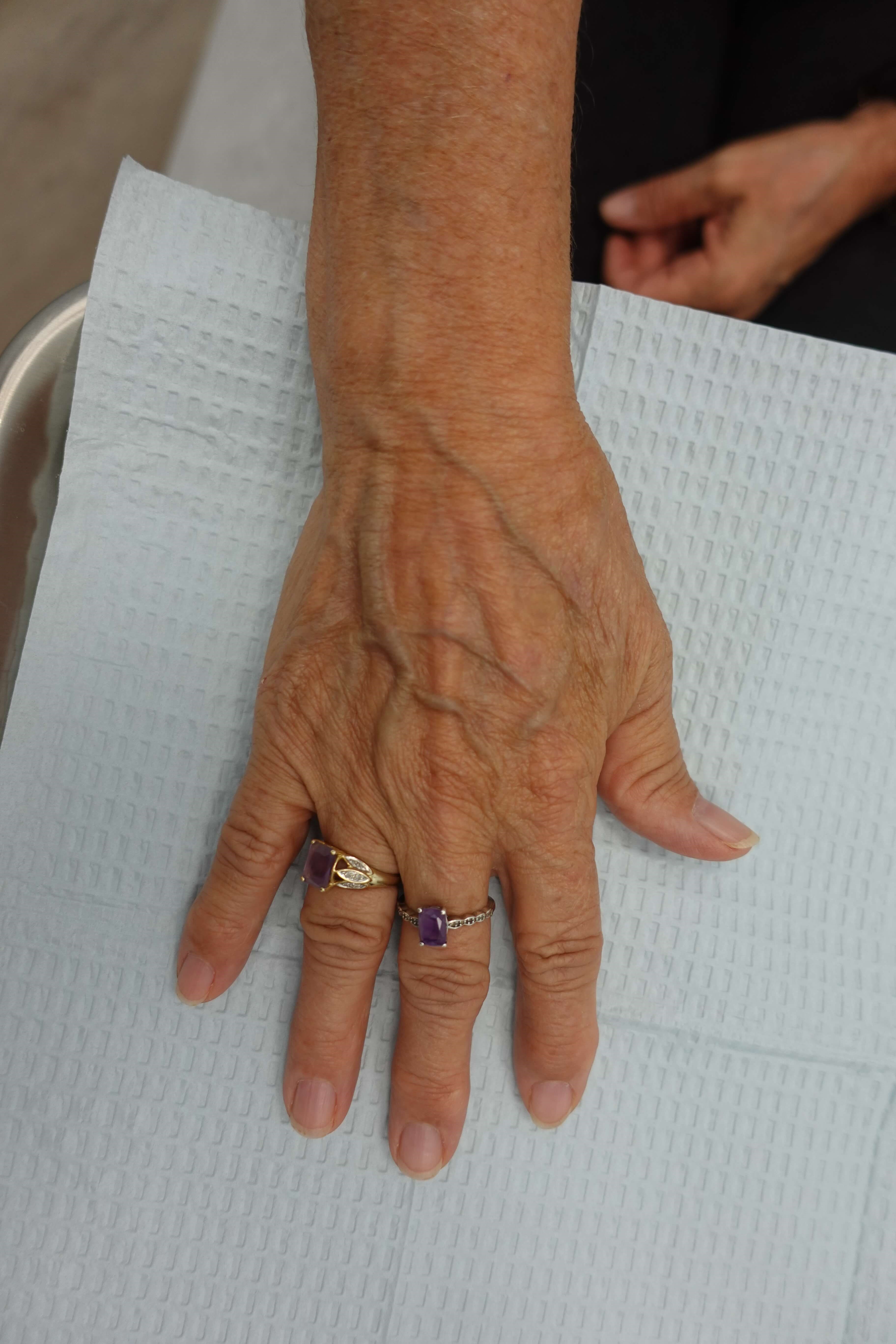 Right Hand After