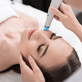 Laser Treatments